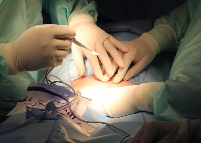 BBL Surgery Nashville TN ⏬⏬ img