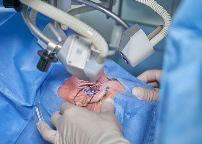 Tom Johnston Back Surgery ⏬⏬ img