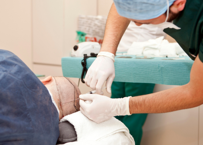 Confidence Restored: How Hair Transplant is Changing Lives img
